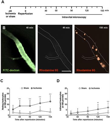 Adhesion of Leukocytes to Cerebral Venules Precedes Neuronal Cell Death and Is Sufficient to Trigger Tissue Damage After Cerebral Ischemia